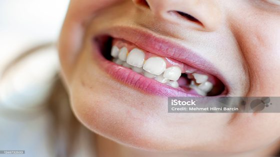 Girl has broken teeth