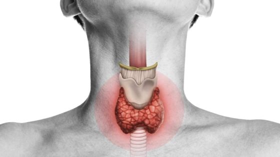 علاج الغدة الدرقية بالطب النبوي