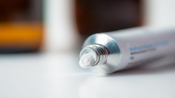 A tube of hydrocortisone cream on a white surface.