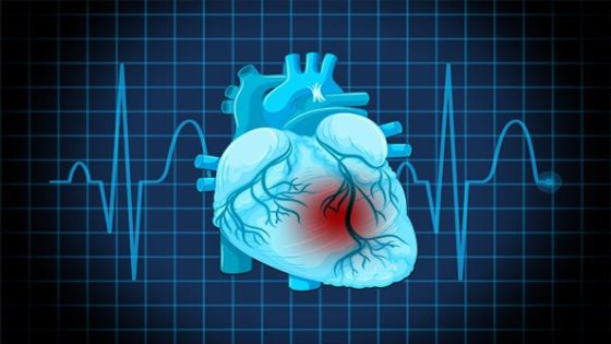 علاج ضربات القلب السريعة المفاجئة